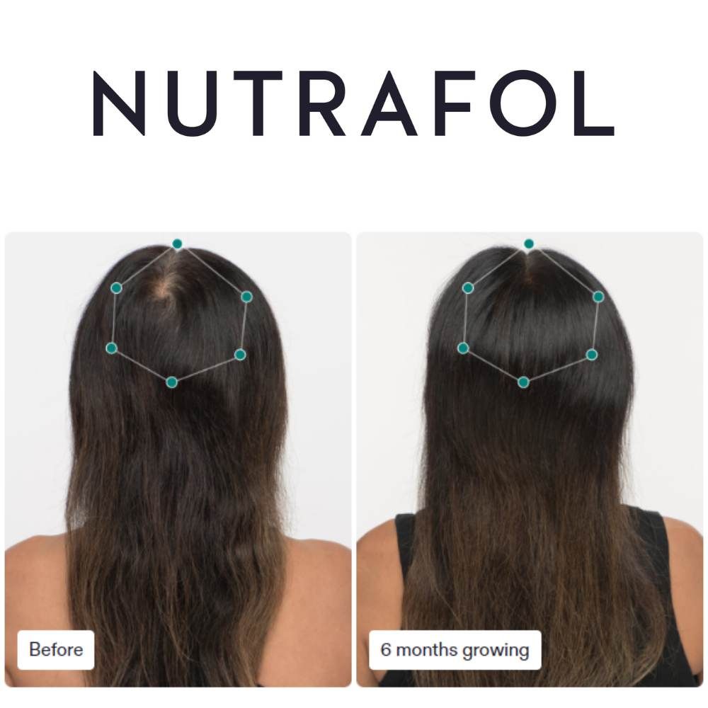 Nutrafol Women's Balance (3-Month Supply)