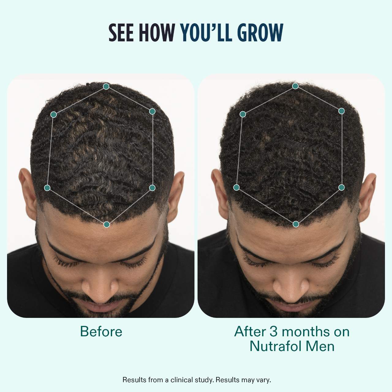 Nutrafol Men (3-Month Supply)